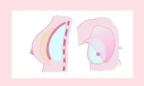 ¡