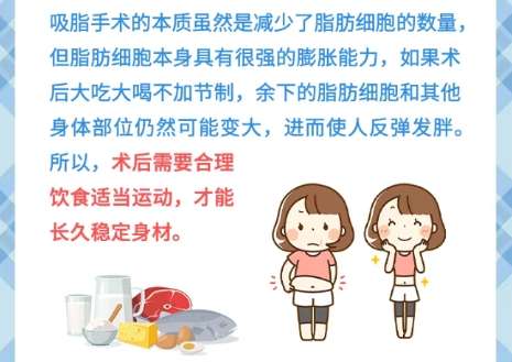 吸脂 吸脂