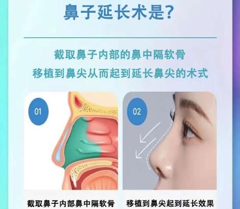 鼻子 鼻子