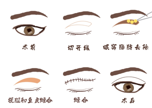 微信截图_20250818003708.png