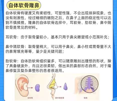 鼻子 鼻子