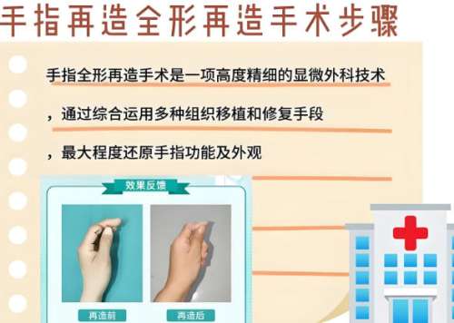 手指整形再造 手指整形再造