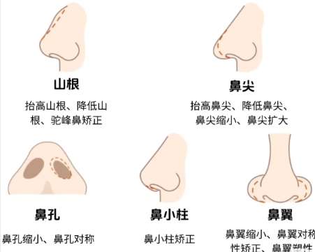 隆鼻 隆鼻
