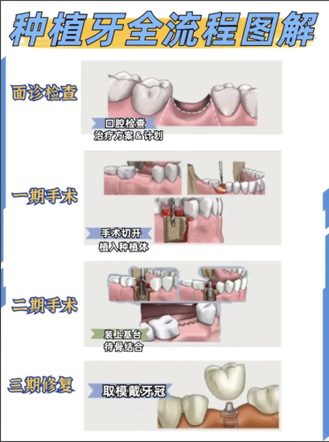 截屏2025-08-22 22.01.01.png