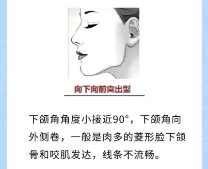 下颌角3.jpg
