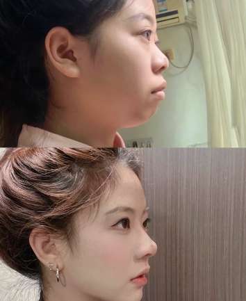 牙齿矫正h01.jpg 牙齿矫正h01.jpg