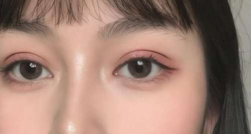 双眼皮 双眼皮