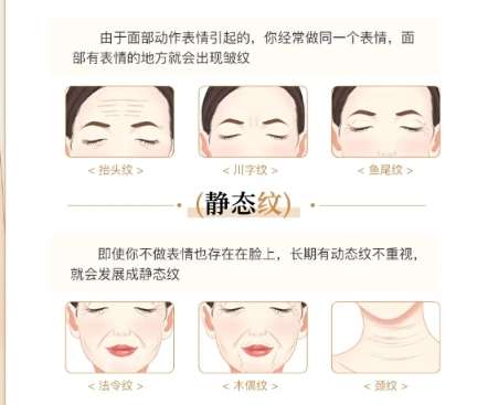 除皱 除皱