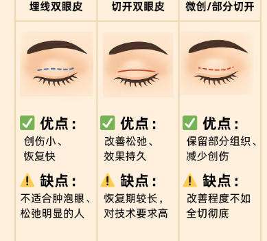 双眼皮 双眼皮