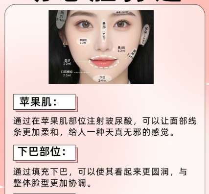 注射美容 注射美容