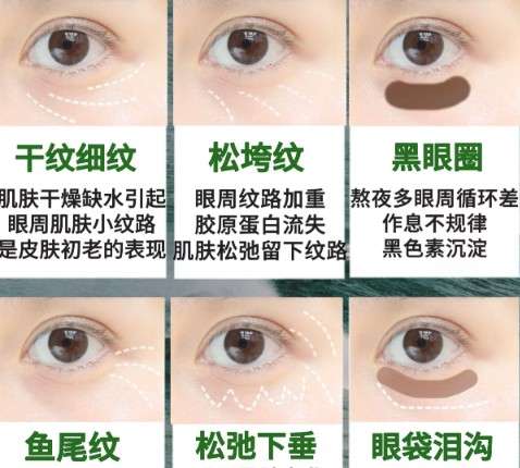 去眼袋 去眼袋