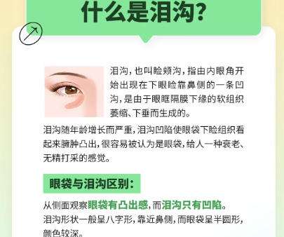 泪沟填充科普.jpg 泪沟填充科普.jpg