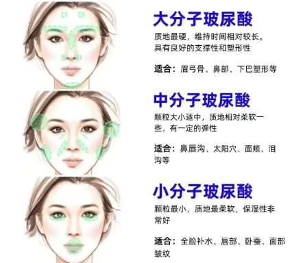 丰下巴 丰下巴