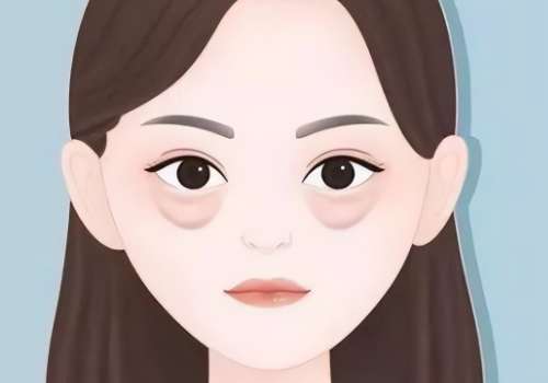 去眼袋.jpg