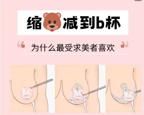 缩胸 缩胸