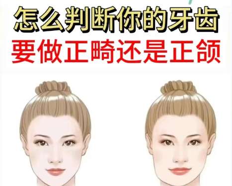 正颌 正颌